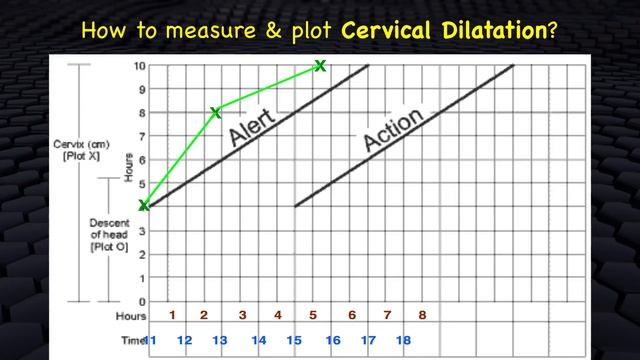 How to plot WHO Partograph смотреть онлайн