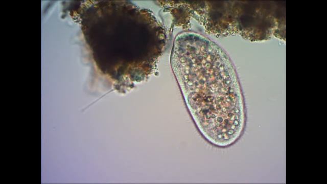 Инфузория туфелька под микроскопом under microscope смотреть онлайн