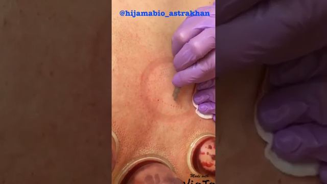 Хиджама смотреть онлайн