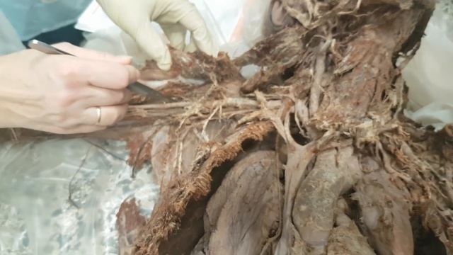 Подключичная артерия