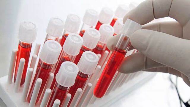 можно ли сдавать анализы во время месячных? смотреть онлайн