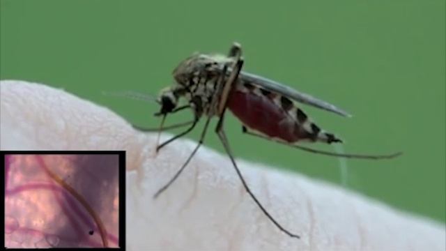 Piqûre de moustique en gros plan et vue au microscope смотреть онлайн