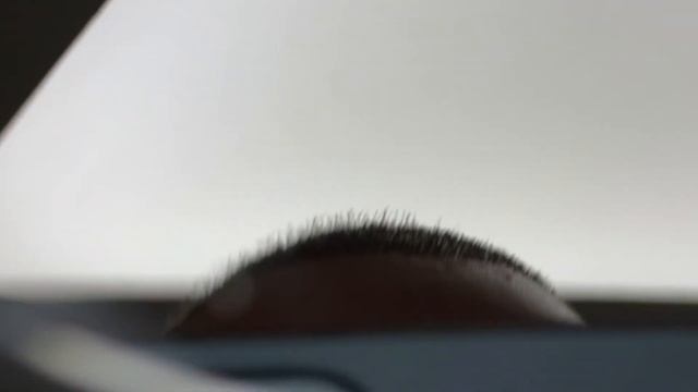 Как правильно стричь волосы после пересадки волос? / Красавчик смотреть онлайн