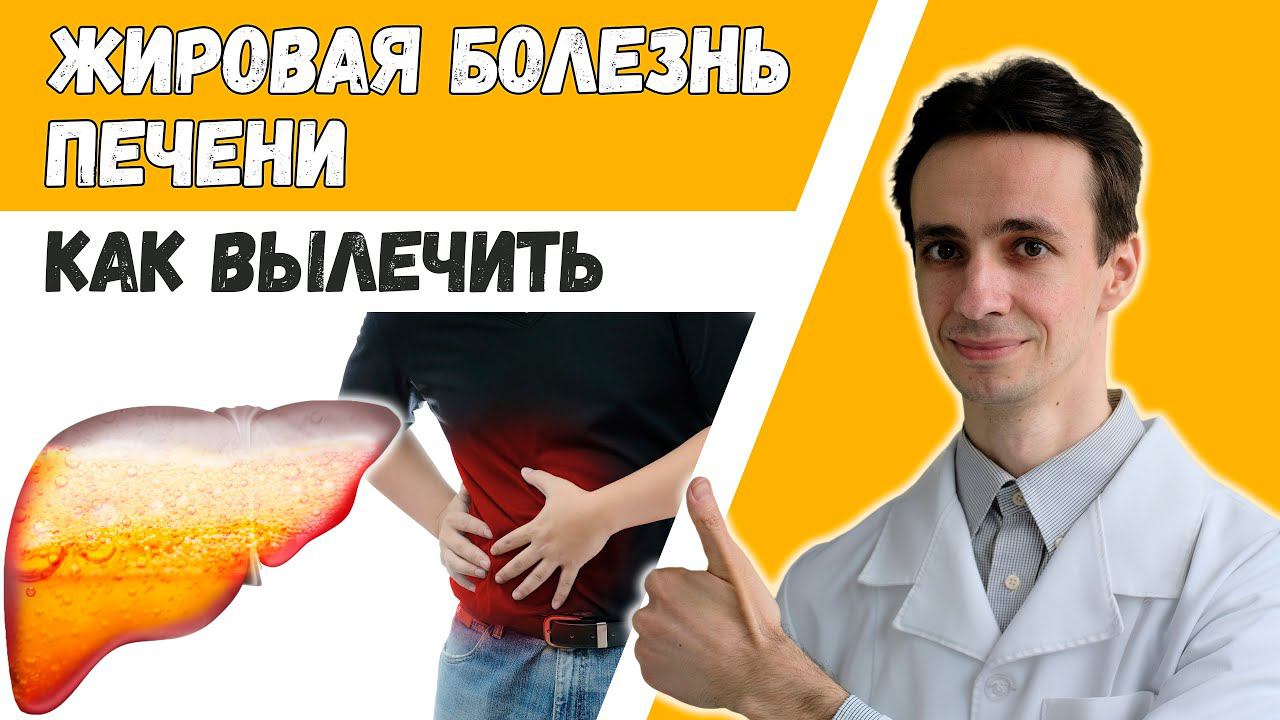 Стеатогепатоз (жировая неалкогольная болезнь печени): натуральные средства лечения, гепатопротекторы смотреть онлайн