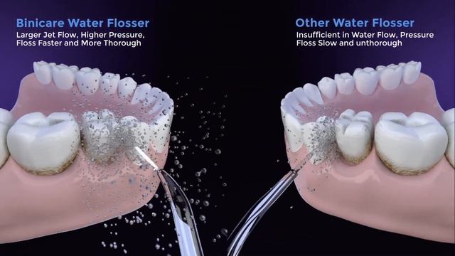 A powerful teeth cleaning tool: Binicare Oral Backer Series Water Flosser for Teeth. смотреть онлайн