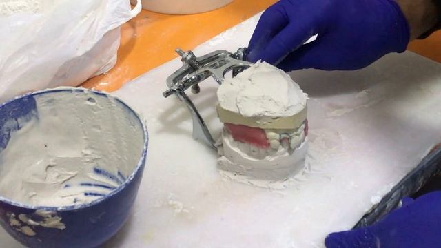 Гипсовка окклюдатора смотреть онлайн