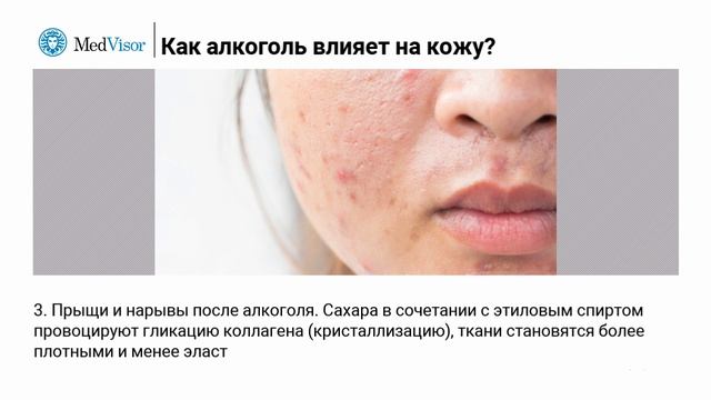 Почему алкоголь портит вашу кожу. 6 скучных фактов смотреть онлайн