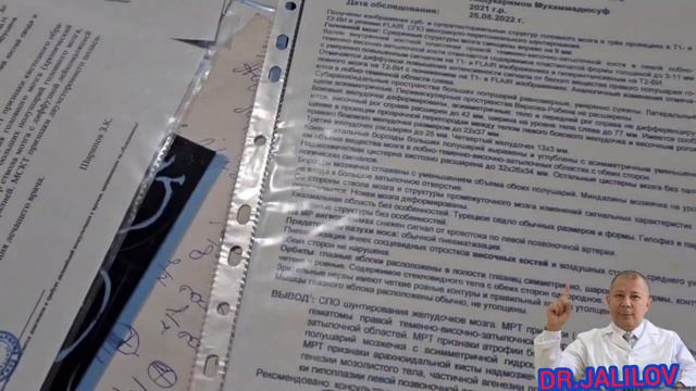 #Ensefalit meningoensefalit /2023.06.02 Dr.JALILOV // смотреть онлайн