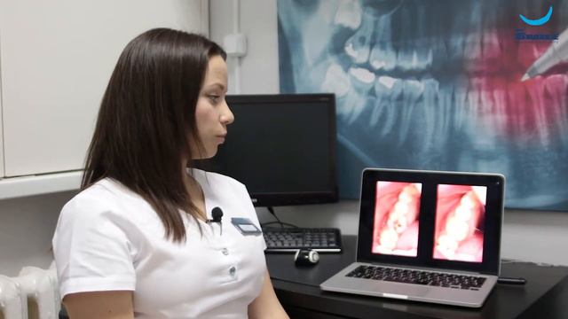 Лечение среднего кариеса. Сафонова Е.Н. Клиника Dr Smile смотреть онлайн