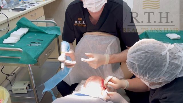 Пересадка волос процедура! смотреть онлайн