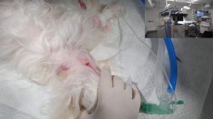 Эзофагостома