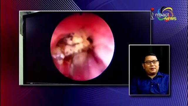Urinary Tract Stone On Impact Health Link 03 June 2019 смотреть онлайн
