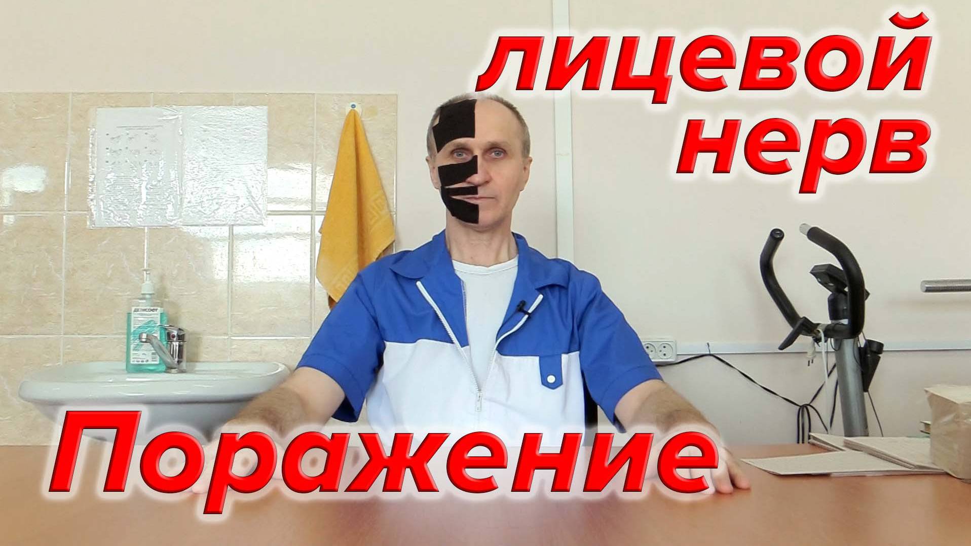 Поражение лицевого нерва. смотреть онлайн