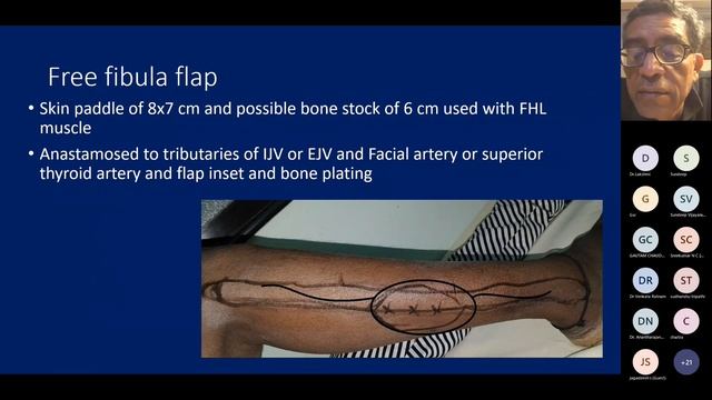 Plastiquest Case Discussion - Carcinoma Buccal Mucosa смотреть онлайн