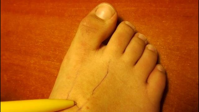 Точка, которой пользуются в ВОЕННОЙ МЕДИЦИНЕ, чтобы моментально Почувствовать Себя Лучше! смотреть онлайн