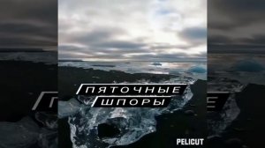 ✨Матрица Гаряева .Пяточные шпоры .