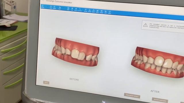Новейшее устройство в стоматологии 2021 года, 3D-сканер, посмотрите на результат ваших зубов 2021 смотреть онлайн
