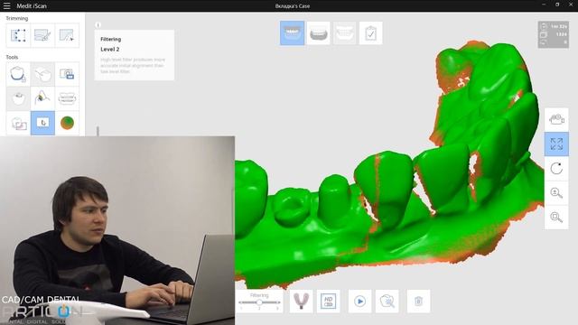 Релиз MEDIT LINK 2.0 - Обзор новых функций