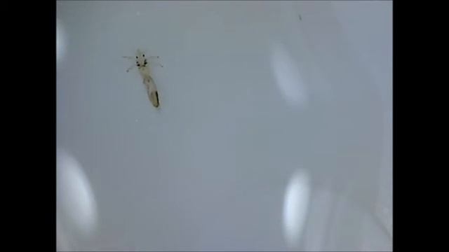 Видео к статье - Педикулез: что делать, если у ребенка вши (5) смотреть онлайн