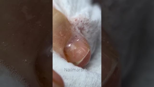 Комбинированный педикюр с универсальной пеной для педикюра #педикюр #педикюрмосква смотреть онлайн