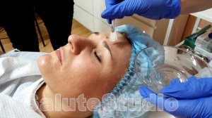 пилинг #джесснера. Только для профессионального использования!!!