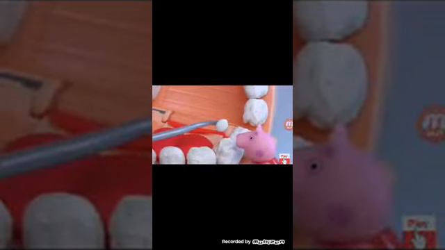 Чёрная дыра в зубе смотреть онлайн