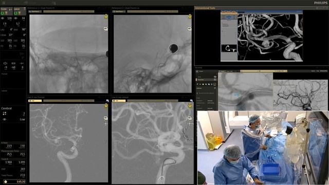 290123 case3 смотреть онлайн