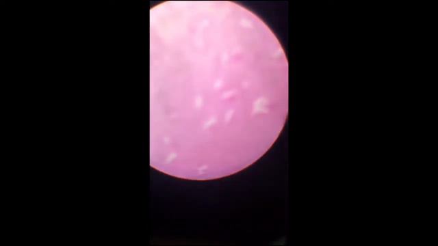 PATHOLOGY 2 || Microscope slides || Final exam || 51 смотреть онлайн