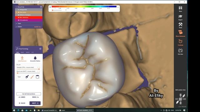 exocad dental cad смотреть онлайн