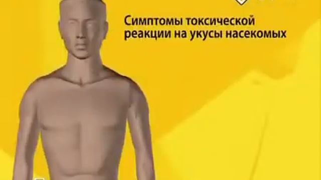 Аптечка Укусы пчел, ос, муравьев смотреть онлайн