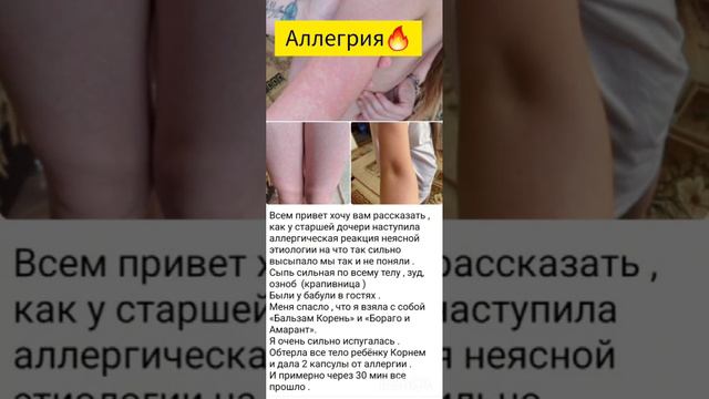 Аллергия👊 смотреть онлайн