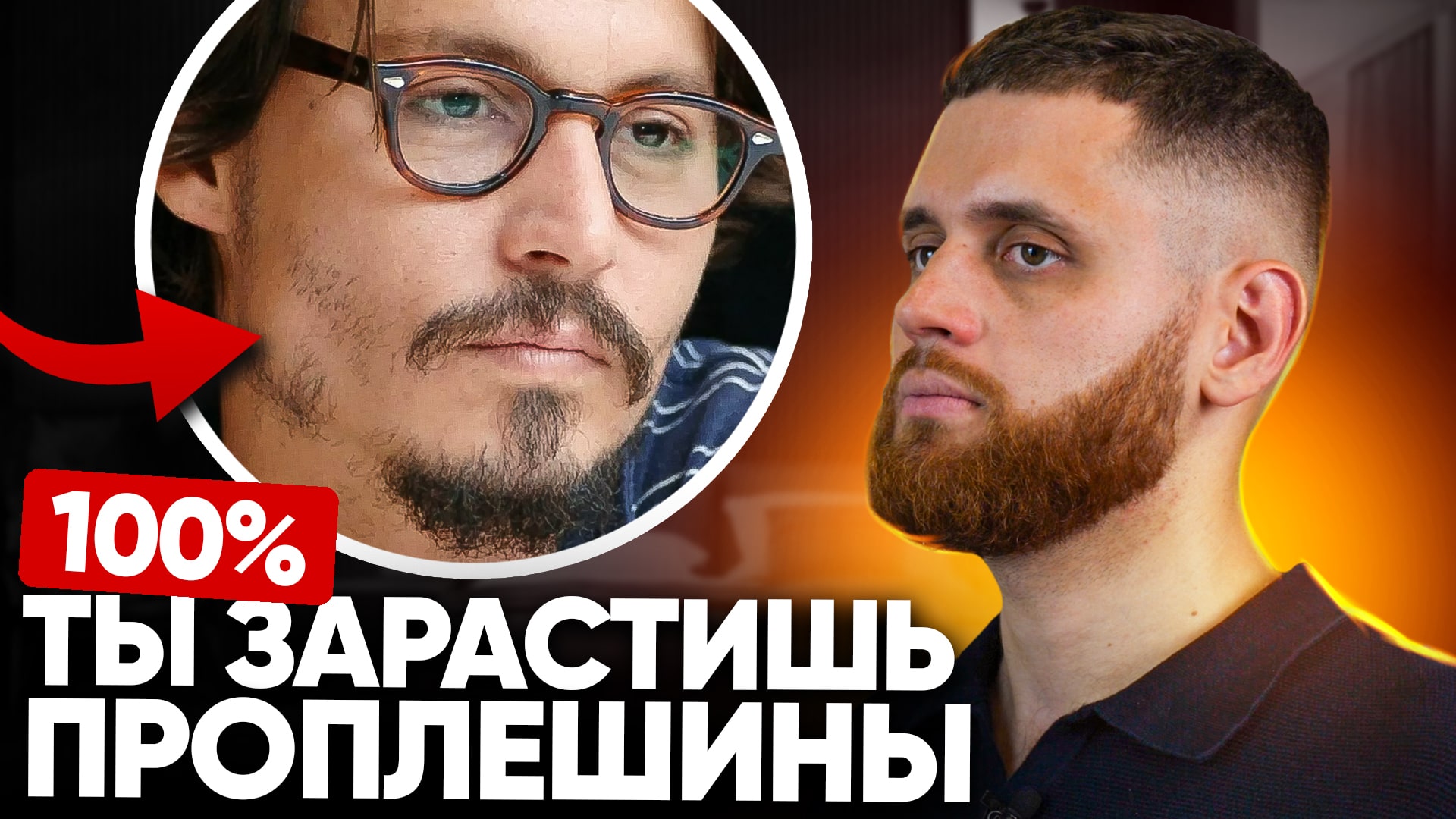 Как зарастить проплешины, чтобы борода была ровная и густая смотреть онлайн