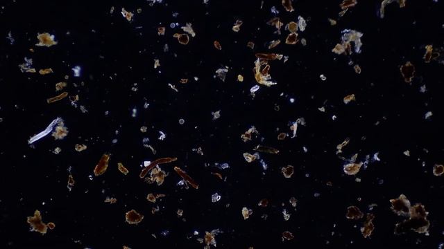 Potting Soil Under Microscope : All These Microorganisms Live In The Potting Mix Of Your Houseplant смотреть онлайн