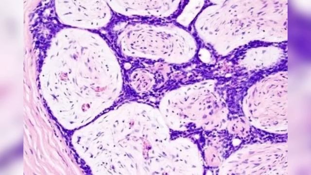 ¿Qué son los seres vivos y cuáles son sus características??? смотреть онлайн