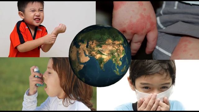 Immunocap Allergy Screening Test