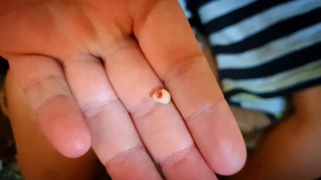 Видео-инструкция: как выдернуть молочный зуб ниткой | Как вырвать молочный зуб