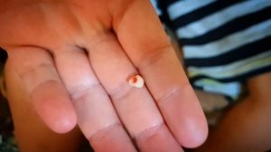 Видео-инструкция: как выдернуть молочный зуб ниткой | Как вырвать молочный зуб