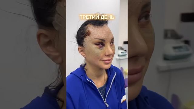 «Лисьи глазки» как вам преображение? ? Доктор ФРОЛОВ М.М. смотреть онлайн