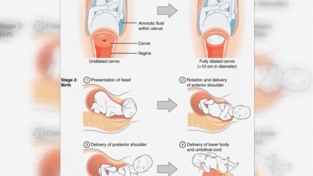 Роды / Childbirth