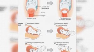 Роды / Childbirth