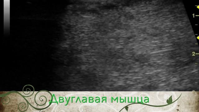 Двуглавая мышца плеча смотреть онлайн