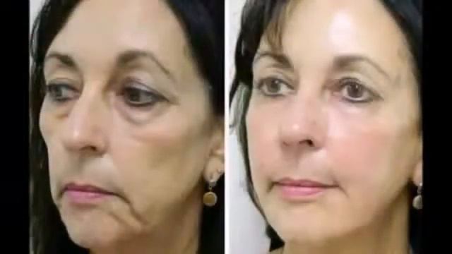 Красота с Jeunesse на основе стволовых клеток смотреть онлайн