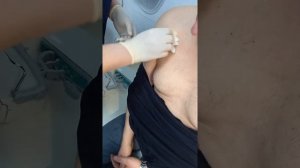 Как поставить иглу Губера/Сурекан в порт-систему?