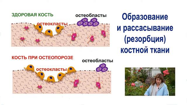 Почему наши кости теряют прочность? смотреть онлайн