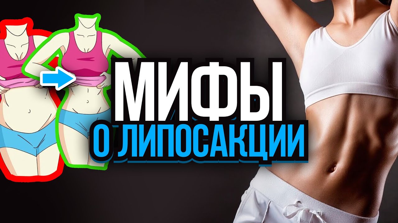 Что нужно знать о липосакции? Реабилитация после липосакции. Растолстеть после процедуры? смотреть онлайн