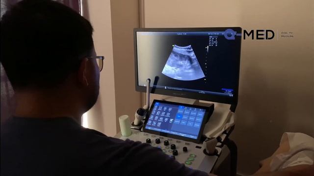 Vinno G86 узи аппарат премиум класса установка в медицинском центре САНА смотреть онлайн