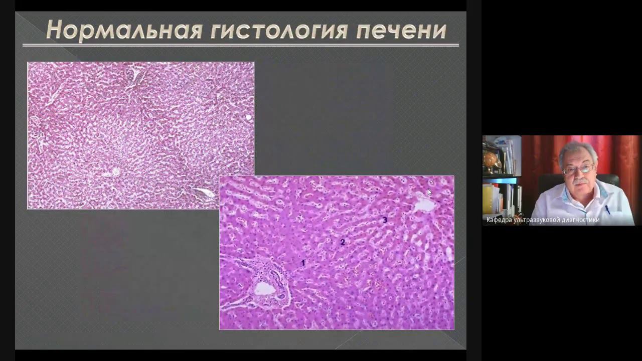 УЗД заболеваний печени 1  Неласов Н Ю