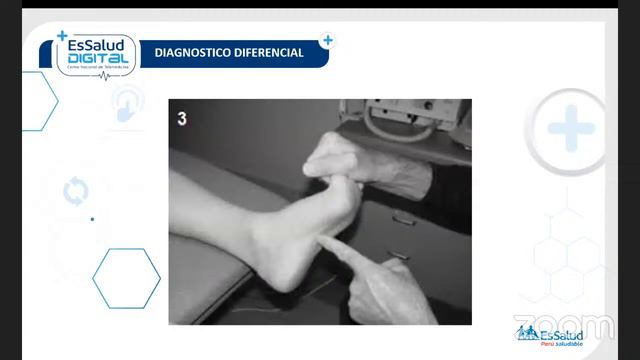 Espolón Calcáneo смотреть онлайн