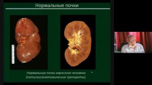 УЗД заболеваний почек  Часть 1 зав каф проф Неласов Н Ю