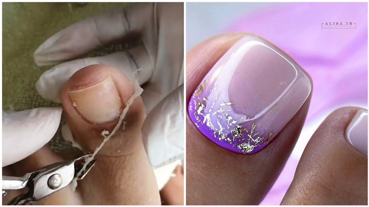 Most Satisfying Pedicure Transformation best nail polish for toes 2024 смотреть онлайн